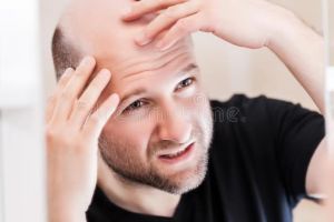 選擇正確的男性脱髮治療方法