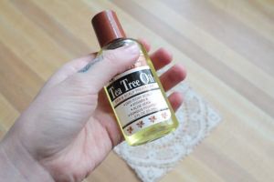 怎麼處理頭皮屑？