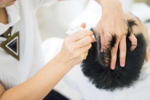 有哪些不同類型的頭皮治療?