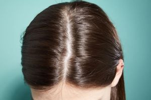 什麼是頭皮損傷?