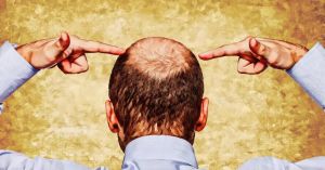 【圖】男性型脱髮的自然療法