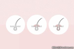 毛囊炎症狀是什麼，毛囊炎怎麼治療？