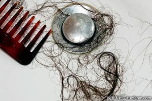 你的頭髮究竟是怎麼掉的？