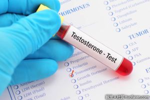 什麼是睾酮水平低?