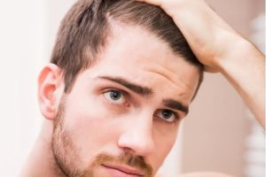 如何控制男性脱髮