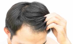 加速頭髮生長 該怎麼樣做