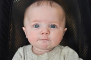 嬰兒的髮際線後退