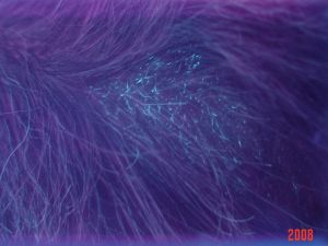 如何治療頭皮真菌？