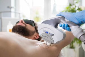 怎樣才能得到最好的激光脱毛效果？