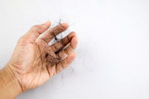 怎樣才能防止脱髮?