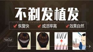 新生植髮：男性植髮術後如何護理頭髮？