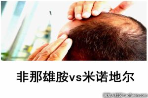 非那雄胺vs米諾地爾：哪一種適合你?