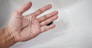 男性脱髮如何影響自尊