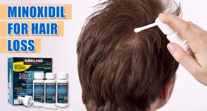 脱髮用藥米諾地爾