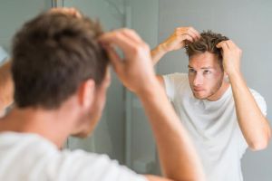 男人防止脱髮的5種方法