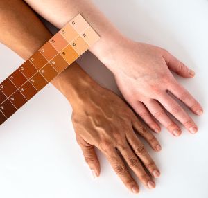 如何促進黑色素的產生