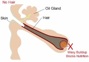 如何知道你的頭皮毛囊是否永久死亡