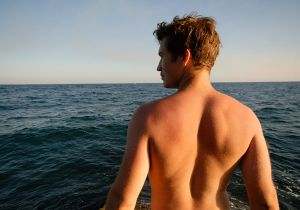 頭皮曬傷有什麼治療方法