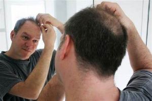 4種已證實的對抗脱髮和再生頭髮的方法