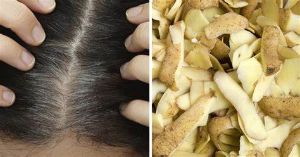 土豆對頭髮和頭皮的美容益處