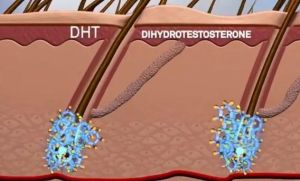 什麼是二氫睾酮DHT？