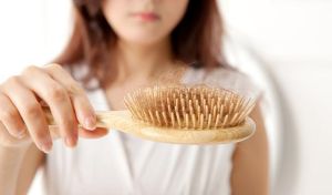 女性脂溢性脱髮如何用藥治療