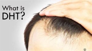 DHT脱髮的原因和治療方法
