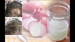 洋葱汁促頭髮生長