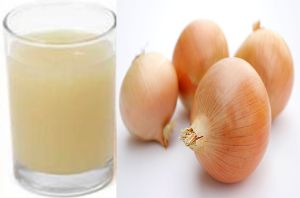 洋葱汁有效治療脱髮的原因及好處
