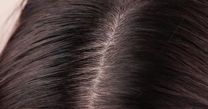 【頭髮護理】為什麼要定期為頭皮深層清潔!