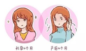 產後脱髮的3點原因