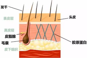 頭皮敏感、油性脱髮、白髮　注意6大頭皮初老變化
