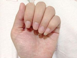 從指甲與舌頭　判斷孩子的健康狀況(上)