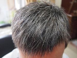 早生白髮與血腎有關? 3個穴位助白髮變黑頭痛都適用