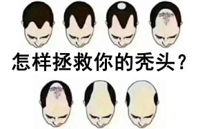 貧血缺蛋白質11個脱髮成因　6個穴位改善髮際線後移Ｍ字額