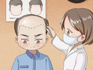 破解植髮疑問 醫：不是植愈多愈好