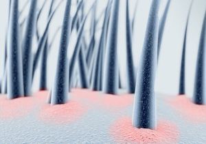 什麼是脂溢性皮炎 原因 症狀 併發症 好發族羣 預防