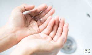 一天掉髮50-100根…正常現象