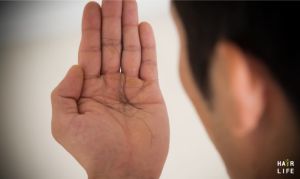 頭髮掉不停、愈來愈稀疏？你可能是這些營養不夠了