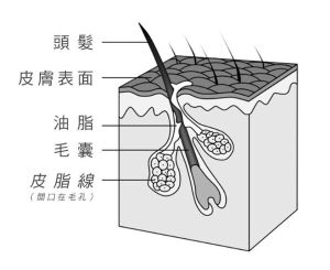「Poo-free」不用洗髮水讓脱髮減少、治好頭皮癢？皮膚科醫師這麼説
