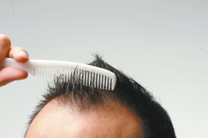 怕掉髮少洗頭？皮膚科醫師：掉更多