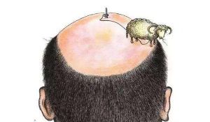 雄性脱髮基因遺傳 也會來自母系