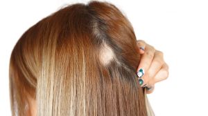 頭髮越洗越稀疏？專家教你選洗髮產品