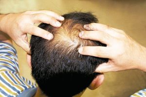 養髮液、生髮液大不同！醫師教你如何分辨頭頂上的需求