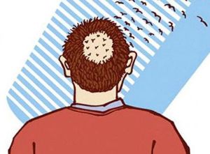 年輕人脱髮 不建議服藥預防