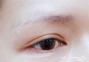 眉毛變稀疏 健康出狀況