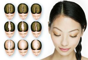 生髮 把握369黃金期