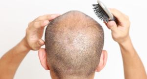 陽痿、掉髮有救了 補充10大含鋅食物