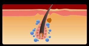 什麼是雄性脱髮？