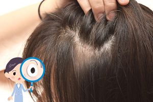 缺鐵易掉髮?養髮你需要這些礦物質和食物